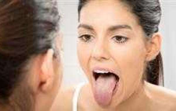9 Fascinating Insights Your Tongue May Reveal About Your Health