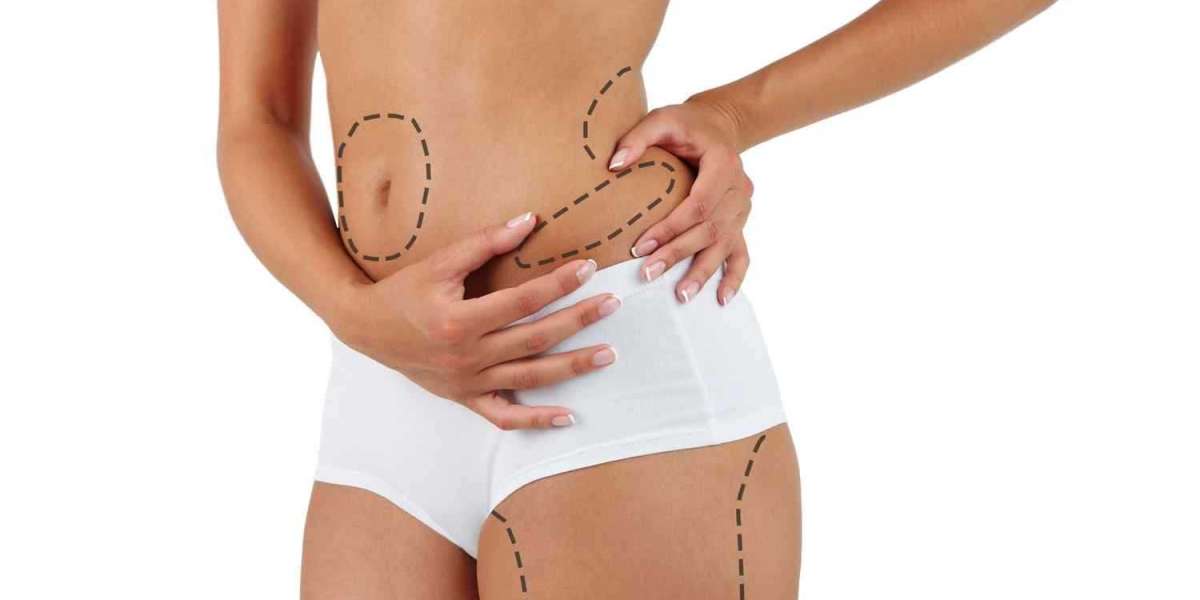 How Much Does CoolSculpting Cost For The Lower Abdomen