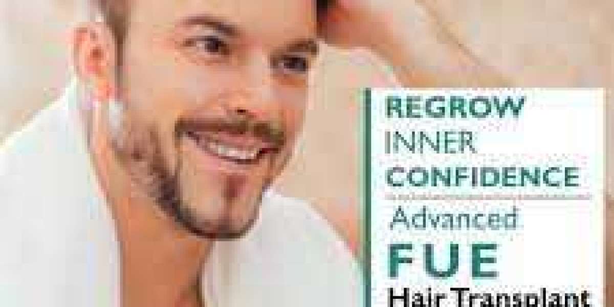 Best hair transplant treatment in delhi - Hairsmith