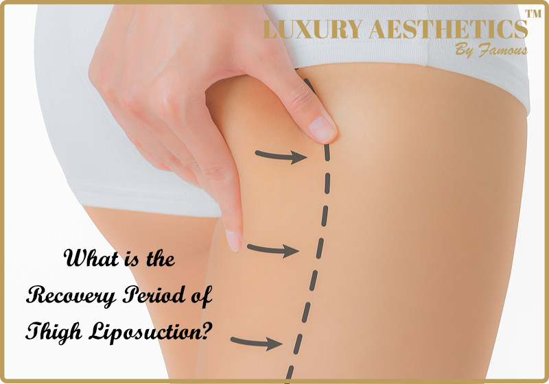 What is the Recovery Period of Thigh Liposuction? – LUXURY AESTHETICS CENTER