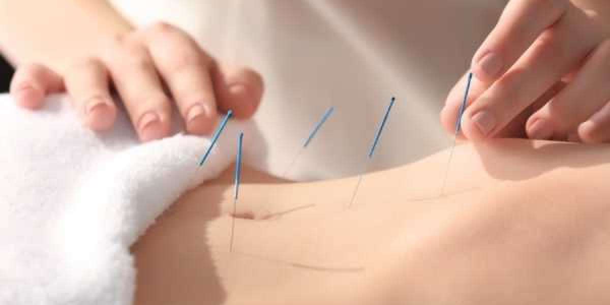 Australia's Leading Cosmetic Acupuncture - 777healthcare.com.au