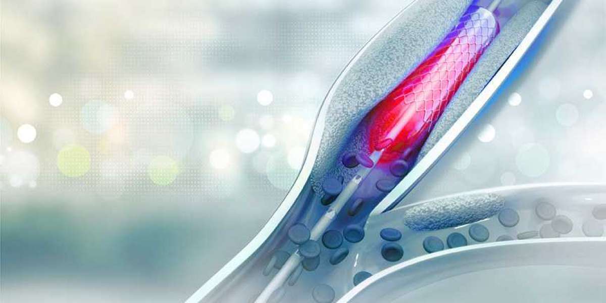 Angioplasty Balloons Market Research Report 2026, Industry Trends, Share, Size, Demand and Future Scope